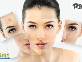 Специална оферта за Лазерно лечение на акне и заличаване на белези с 40% отстъпка, предоставено от Центрове Енигма