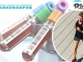 Специална оферта за Следи своето здраве! Пакет изследвания Фитнес, от СМДЛ Кандиларов